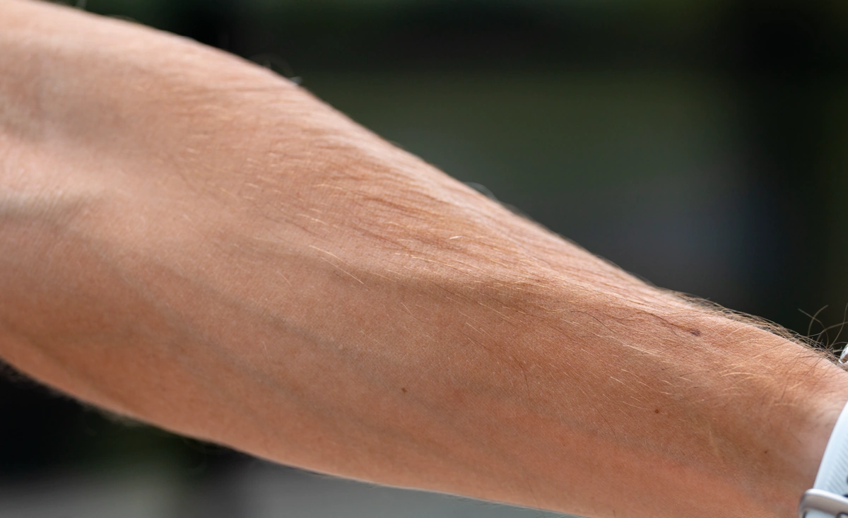 Sport SPF 30 - AFTER