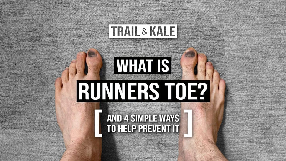What is Runners Toe and 4 Ways To Prevent Black And Bruised Toenails From Running by Trail and Kale v2
